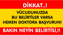 Dikkat Vücudunuzda Bu Belirtiler Varsa Hemen Doktora Gidin
